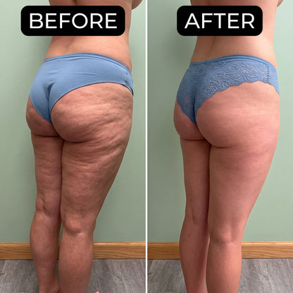 Syabeauty BodyForm 3-in-1