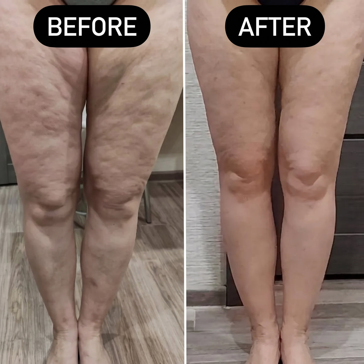 Syabeauty BodyForm 3-in-1